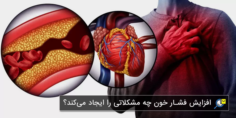 عوارض و مشکلات ناشی از فشار خون بالا